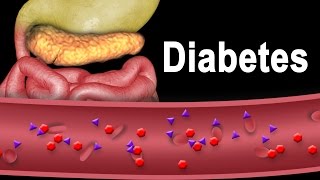 Diabetes Type 1 and Type 2 Animation [upl. by Abehsile]