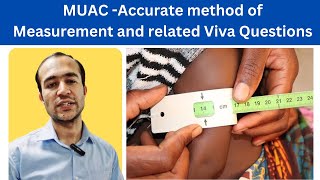 MUAC tape and measurements procedure  Mid upper arm circumference  Malnutrition  SAM and MAM [upl. by Assilev284]