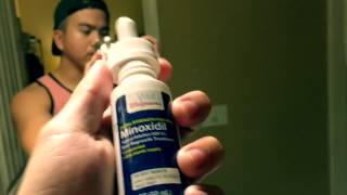 Wait Minoxidil Works Beard Growth FilipinoAsian  1month [upl. by Jalbert]