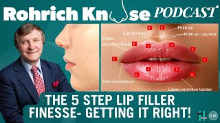 The 5 Step Lip Filler Finesse Getting it Right [upl. by Beth]