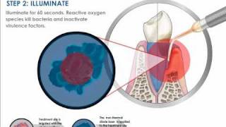 Understanding Photodisinfection [upl. by Trenton339]