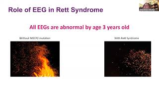 RettEd Epilepsy Treatments in Rett Syndrome feat Robin Ryther MD PhD [upl. by Anitram489]