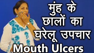 मुहं के छालों के घरेलू उपचार । Home remedies for Mouth Ulcers  Ms Pinky Madaan [upl. by Travax]