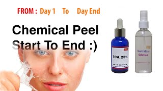 Chemical peel at Home Rejsol 25 Tca [upl. by Durante]