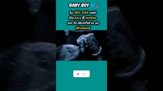 Baby boy v girl baby 🤰💙💜pregnant babygirl gender shorts [upl. by Oaoj]