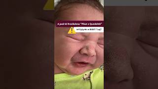 Lekura e bebit Pikat ne lekure milie skin baby babycrying lekura babyskincare babyvideos [upl. by Shakespeare]