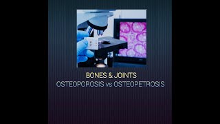 Osteoporosis and Osteopetrosis systemicpathology osteoporosis osteopetrosis diseasesofbone [upl. by Hacceber777]