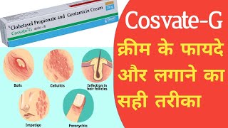 Cosvate G Cream Uses In Hindi  Clobetasol Propionate And Gentamicin Cream  Uses Side Effects [upl. by Enyrhtak]