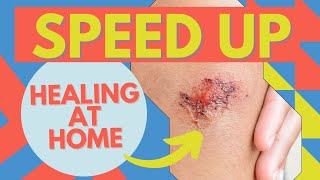 Wound Care How To Heal Faster At Home [upl. by Reisinger612]