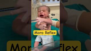 Moro reflex in newborn babyviral [upl. by Sille820]