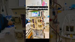 Plasmapheresis With Advanced Dialysis Machine nephrology kidneyhealth kidneydisease ytshorts [upl. by Ohaus]