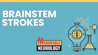 Brainstem Stroke Mnemonics Memorable Neurology Lecture 15 [upl. by Asselim]