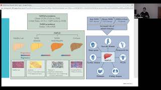 Hepatic Steatosis NASH vs NAFLD vs MAFLD [upl. by Ineslta404]