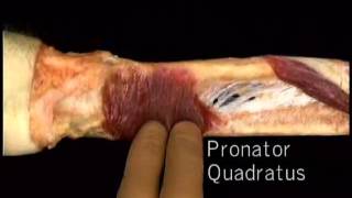 pronator quadratus muscle [upl. by Hacceber103]