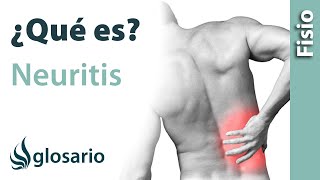 NEURITIS  Qué es qué afecta síntomas signos clínicos causas y tratamiento fisioterapéutico [upl. by Angi]