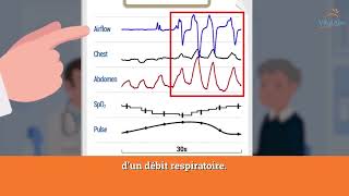 Polygraphie bien comprendre les résultats de mon examen du sommeil [upl. by Neehsuan]