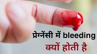 Pregnancy me blood ka aana  blood spotting during pregnancy [upl. by Landsman834]