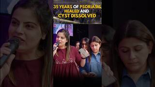 35 years of Psoriasis healed and cyst dissolved [upl. by Yrome985]