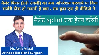 Mallet Finger Treatment In Hindi  मैलेट फिंगर की कब सर्जरी करवाये Everything about mallet finger [upl. by Bergmann22]