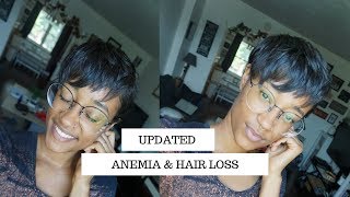 Anemia Hair Loss  Natural Hair Journey Update with Blood Builder Iron Pills and Floradix Iron [upl. by Nelly]