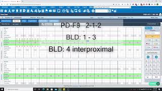 DentiAI Voice  Denticon Demo [upl. by Curt]