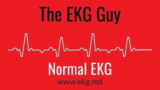 Normal EKG  The EKG Guy  wwwekgmd [upl. by Ettenej]