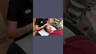 Fotopeel treatment at Woodford Medical [upl. by Eloci]