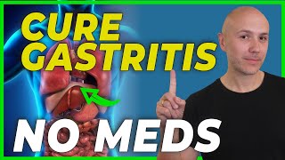 HOW to CURE GASTRITIS without medications  DR CARLOS [upl. by Chapell]