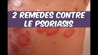 😲2 REMÈDES NATURELS CONTRE LE PSORIASIS ★★★★★ [upl. by Falito762]