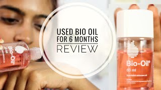 Bio Oil Review  Does Bio Oil Work on Stretch Marks amp Scars  SuperWowStyle [upl. by Ardnola]