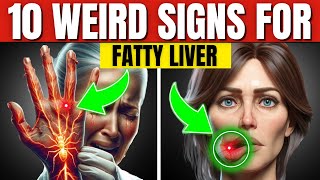 10 Weird Signs for Fatty Liver [upl. by Pierro]