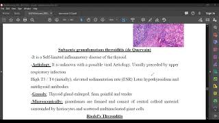 de Quervain amp Riedels Thyroiditis [upl. by Moriarty77]