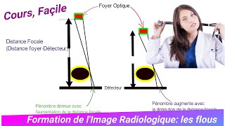 Formation dImage Radiologique  les Flous  Bases Physiques dImagerie Médicale [upl. by Sternberg]