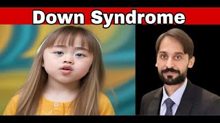 Down syndrome  Down Syndrome Baby  Down Syndrome Kid  MLT Hub with kamran [upl. by Niwre]