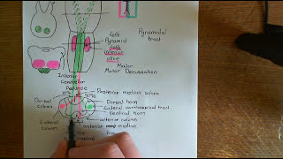 Amyotrophic Lateral Sclerosis ALS Part 4 [upl. by Nnauol]