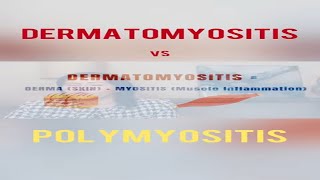 Dermatomyositis vs Polymyositis  What is the difference dermatomyositis polymyositis [upl. by Marlowe]