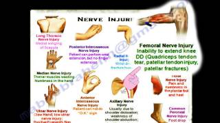 Nerve Injuries Summary Thank You Card  Everything You Need To Know  Dr Nabil Ebraheim [upl. by Hutt]