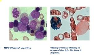 cytochemical staining [upl. by Ynolem]