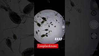 Identification of Zooplankton 😍 under Microscope🔬 plankton shorts aquaculture farming ytshorts [upl. by Sihunn]