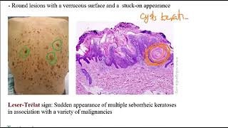 USMLE ACE Video 192 Skin Disorders Overview [upl. by Molly]