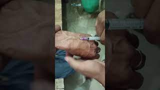 IV injection  nursing staff sortvideo real viralshort [upl. by Keeryt372]