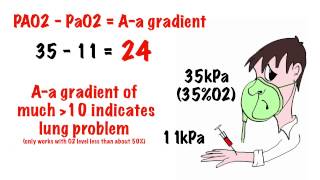 Arterial blood gas interpretation in 5 min [upl. by Lareena]