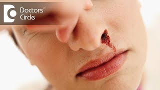 What are the causes of sudden nose bleed  Dr Lakshmi Ponnathpur [upl. by Pinto18]