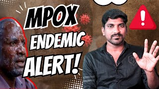 Mpox Outbreak Symptoms History and Latest Emergency Explained  Tamil  TP [upl. by Enilaf]