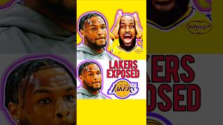 BronnyJames FAKE INJURY EXPOSED ‼️🤯 LAKERS NBA SHORTS [upl. by Eidas389]