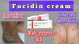 Fucidin cream  Benefits  Side effects  Price  How it works in body and How to get best results [upl. by Dempster468]