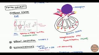 Diabetic Nephropathy for USMLE Step1 and USMLE Step 2 [upl. by Aynav893]