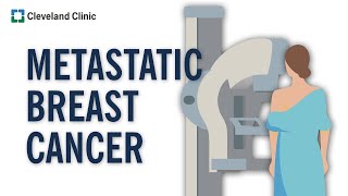 What Is Metastatic Breast Cancer [upl. by Dafodil525]