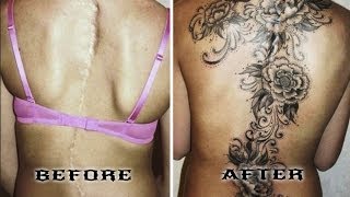 Amazing ScarCovering Tattoos  Epic Cover Up [upl. by Pease9]