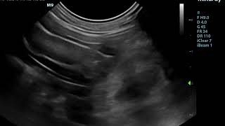 Small Animal Ultrasound  Foreign Body obstructing the Small intestine [upl. by Attayek]